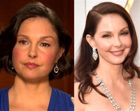 ashley judd plastic surgery|Ashley Judd responds after being criticized for her appearance